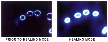 kirlian.gif